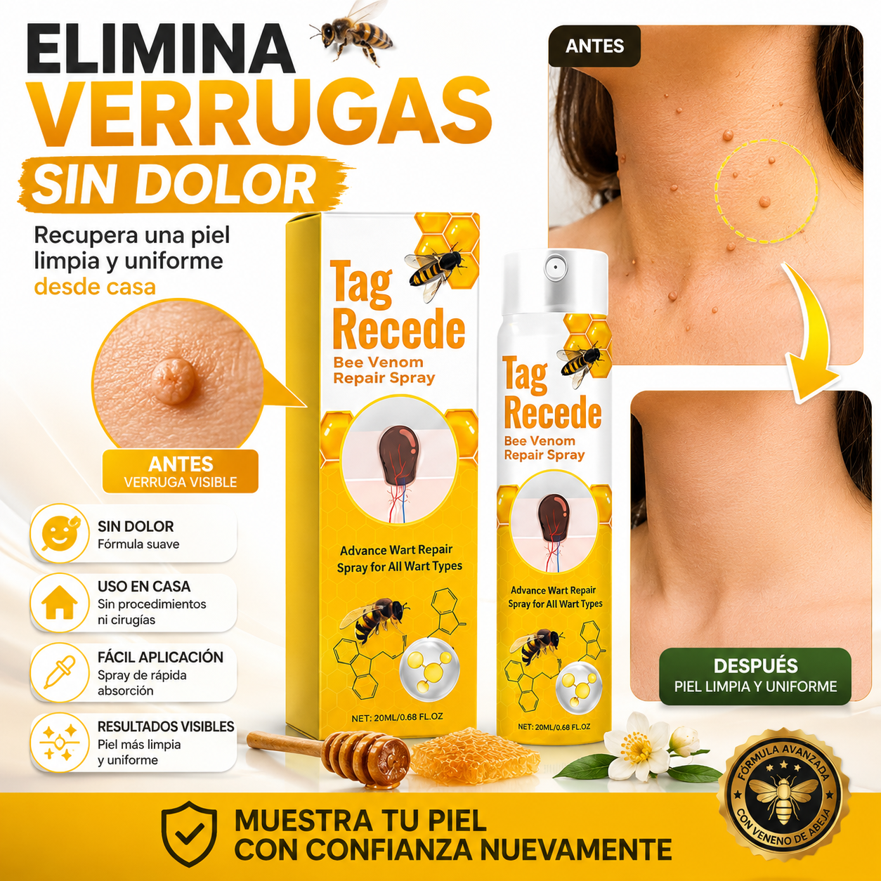 Tag-Recede™ – Elimina Verrugas Sin Dolor y Desde Casa